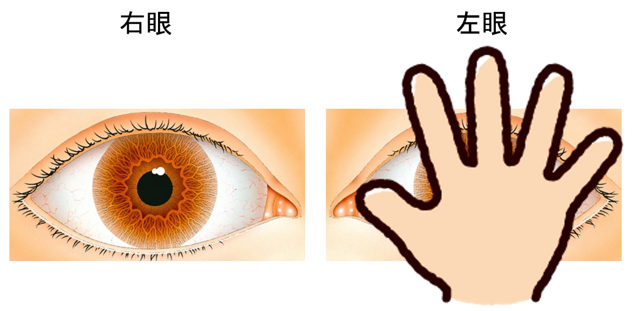 AMED 成育疾患克服等総合研究事業 | 乳幼児期に発症する疾患・障害の